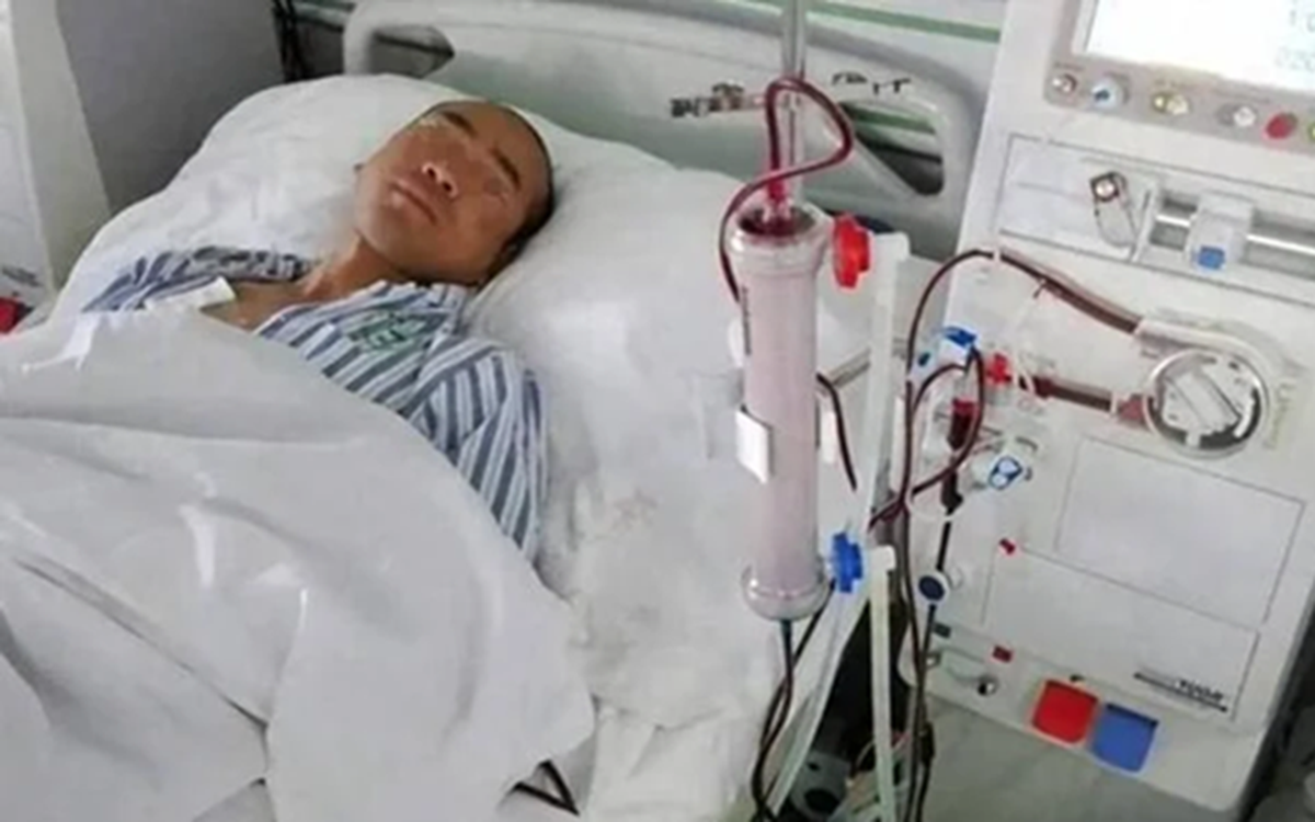 Nam công nhân xây dựng 44 tuổi suy thận cấp do thiếu nước trong ngày nắng nóng