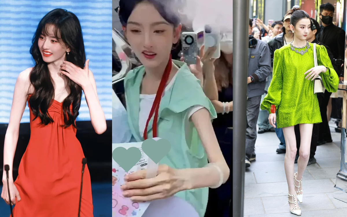 Tống Tổ Nhi và mối nguy sức khỏe khi phụ nữ quá gầy: 5 Điều cần biết