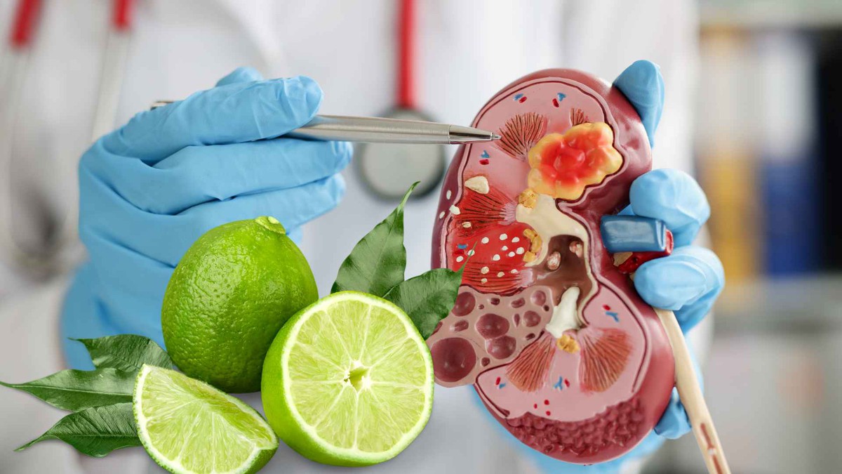 Uống nước chanh có làm sạch thận và ngăn ngừa sỏi tiết niệu không?
